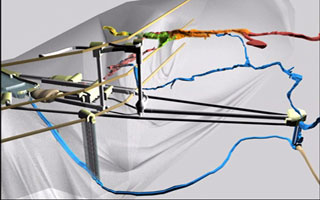 Ombla Hydropower Plant - Public information 